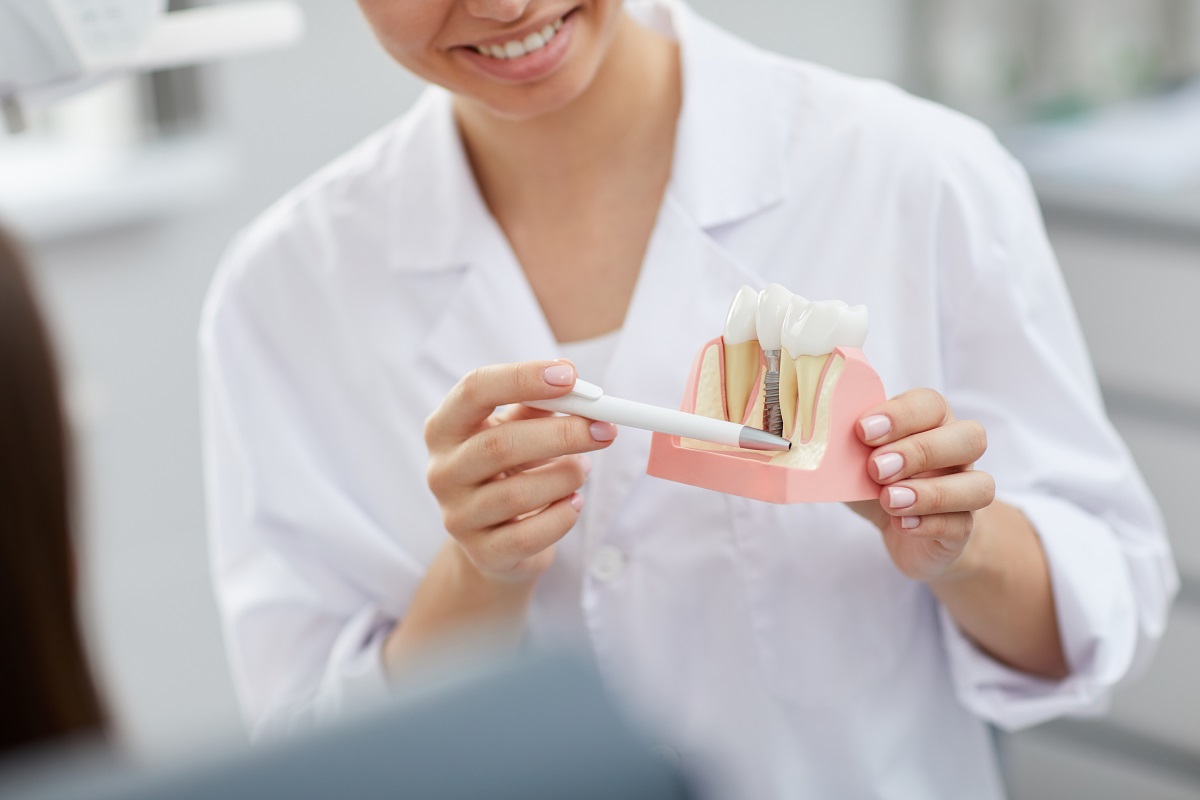 Jakie są rodzaje implantów stomatologicznych?